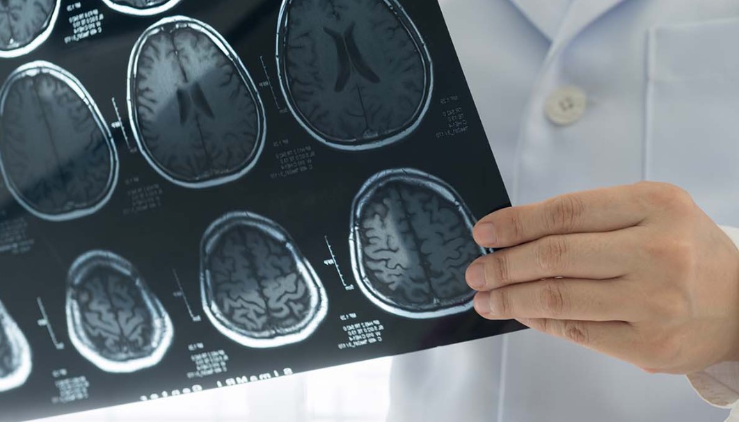 Rekomendasi-Produk-untuk-Pencegahan-Stroke